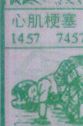 心肌梗塞