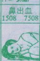 鼻出血