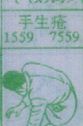 手生疮