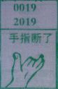 手指断了